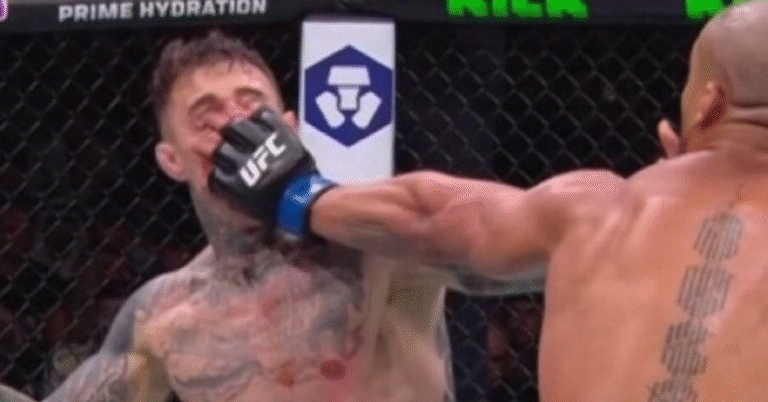 MMA Community Dismisses Chael Sonnen And Anthony Smith’s Tom Aspinall Criticism After UFC 321 Eye Poke