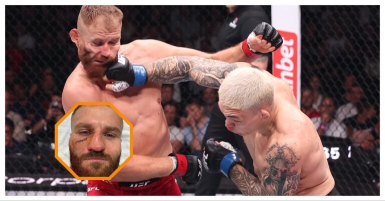 Jan Blachowicz Shows Off Stitched-Up Face As He Appears To Be In Good Spirits Post-UFC Belgrade Loss
